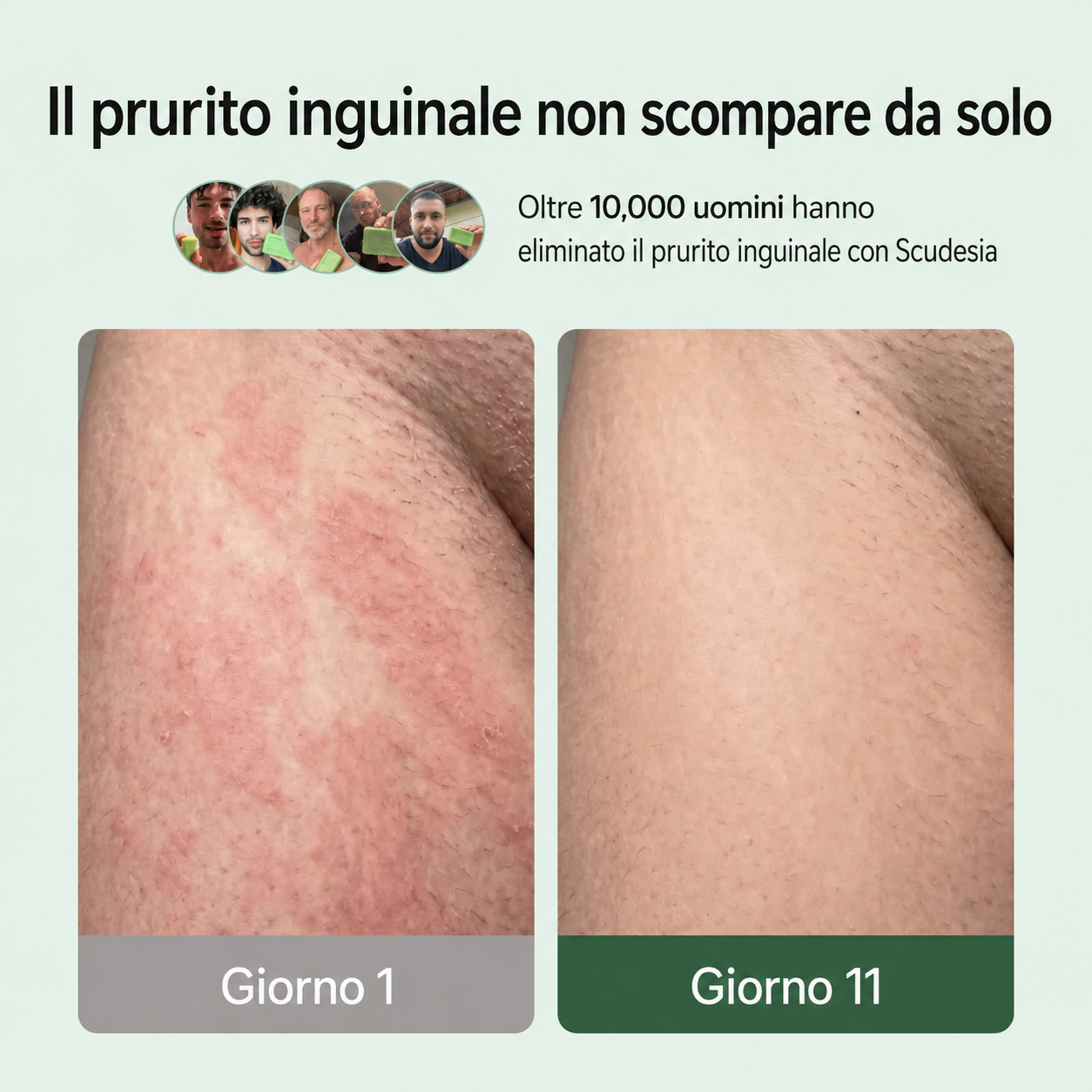 Sapone antimicotico Scudesia